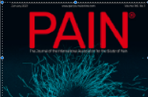 IASP Seeks the Next Editor-in-Chief of PAIN
